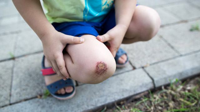 Isang estudyante nagtamu ng sugat matapos mahulog mula sa sahig.